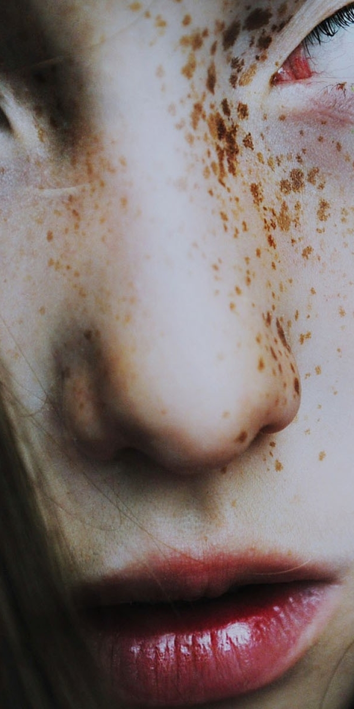 Freckled Brunette